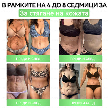 Коледна промоция🎄𝐆𝐞𝑒𝑙𝑒𝐦𝐨𝐧® Glum𝐚𝐬𝐞tide 8 в 1 – Нано микроиглен пластир за отслабване|Само 1× дневно ✅ Видими промени за 7 дни – при затлъстяване, сърдечно-съдово здраве, диабет и ставни проблеми