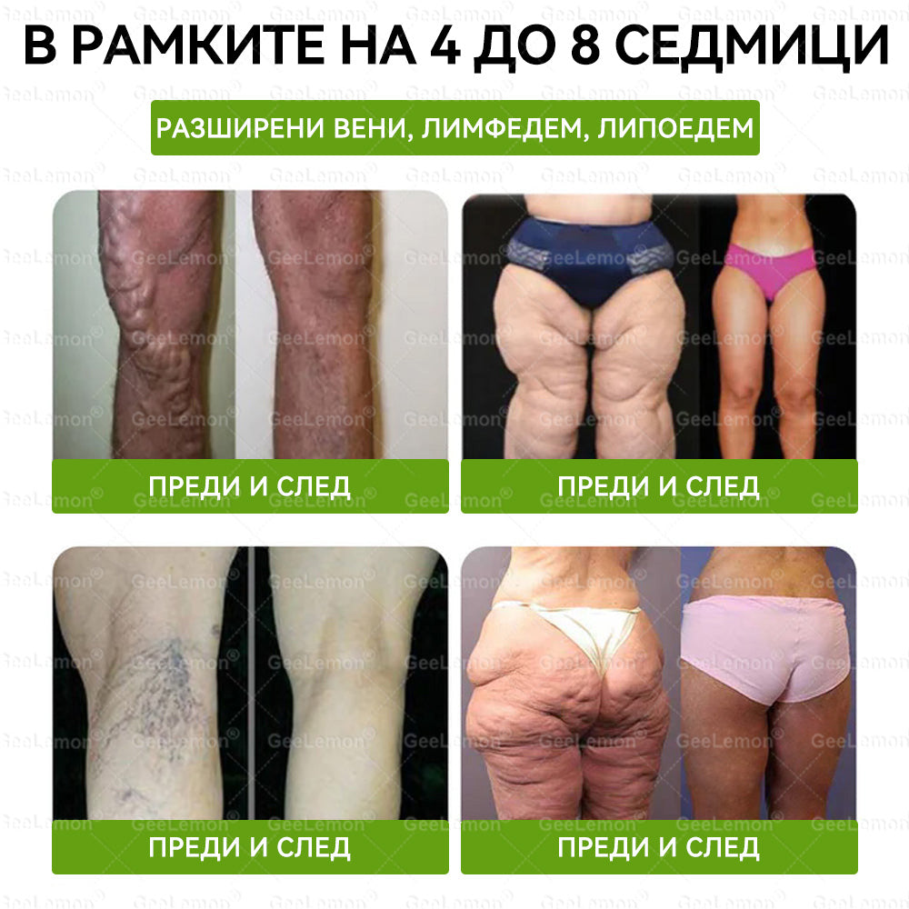 Коледна промоция🎄𝐆𝐞𝑒𝑙𝑒𝐦𝐨𝐧® Glum𝐚𝐬𝐞tide 8 в 1 – Нано микроиглен пластир за отслабване|Само 1× дневно ✅ Видими промени за 7 дни – при затлъстяване, сърдечно-съдово здраве, диабет и ставни проблеми